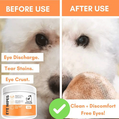 Eye Wipes
